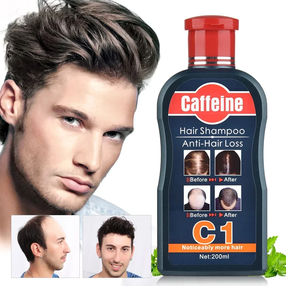 Hair Care Korean Products - Mannen Shampoo Voor Haargroei Natuurlijke Planten