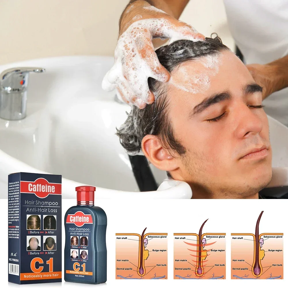 Mannen Shampoo Voor Haargroei  - Hair Care Korean Products recensie en prijs