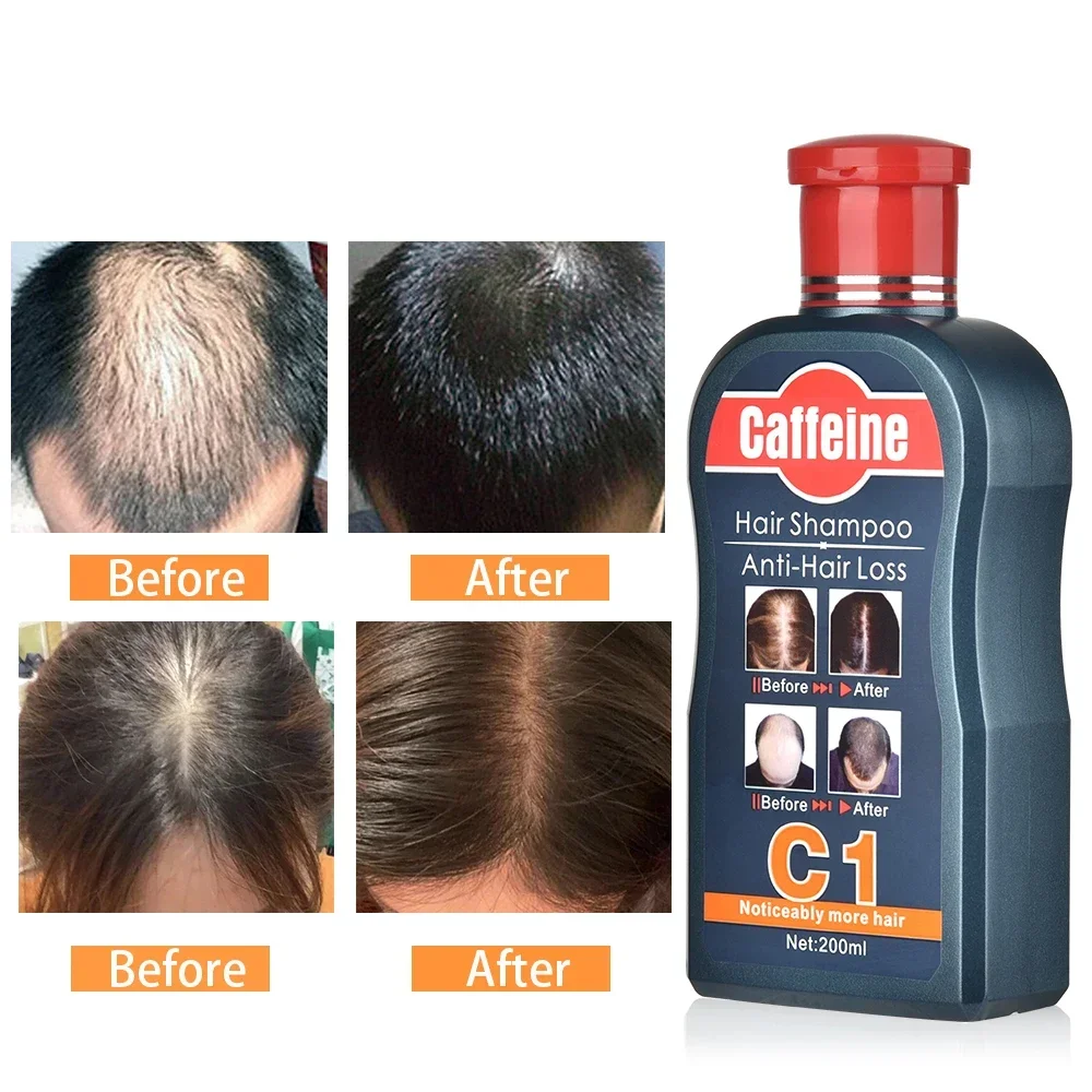 Mannen Shampoo Voor Haargroei  - Hair Care Korean Products recensie en prijs